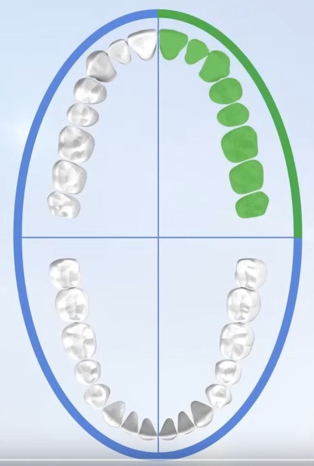teeth discoloration treatment in Boston