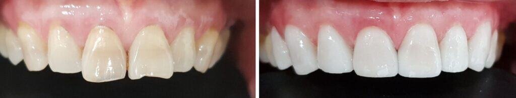 smile design dentistry in boston